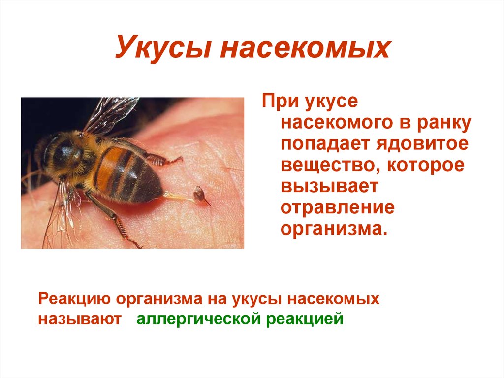 Тема укусы насекомых. Укусы ядовитых насекомых. Симптомы при укусах насекомых. Признаки укуса насекомых.